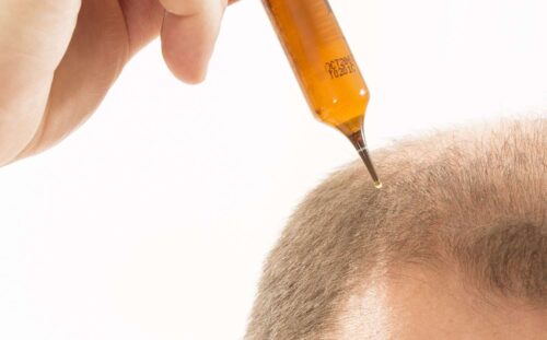 Hızlı iyileşen saç ekimi ve kök onarımı yapan serum görseli