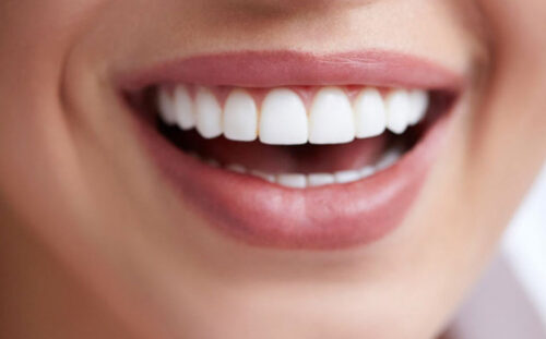 Gülüş tasarımına örnek, estetik dişlere sahip kadın fotoğrafı
